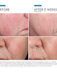 Phyto Corrective Essence Hydrating Mist