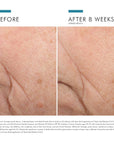 Triple Lipid Restore 242 Anti-Ageing Moisturiser