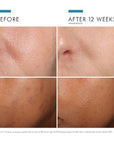 Phloretin CF Serum Vitamin C Serum