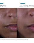 Silymarin CF Vitamin C Serum for Oily Skin
