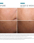 Discoloration Defense