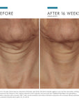 Tripeptide-R Retinol Neck Repair Cream