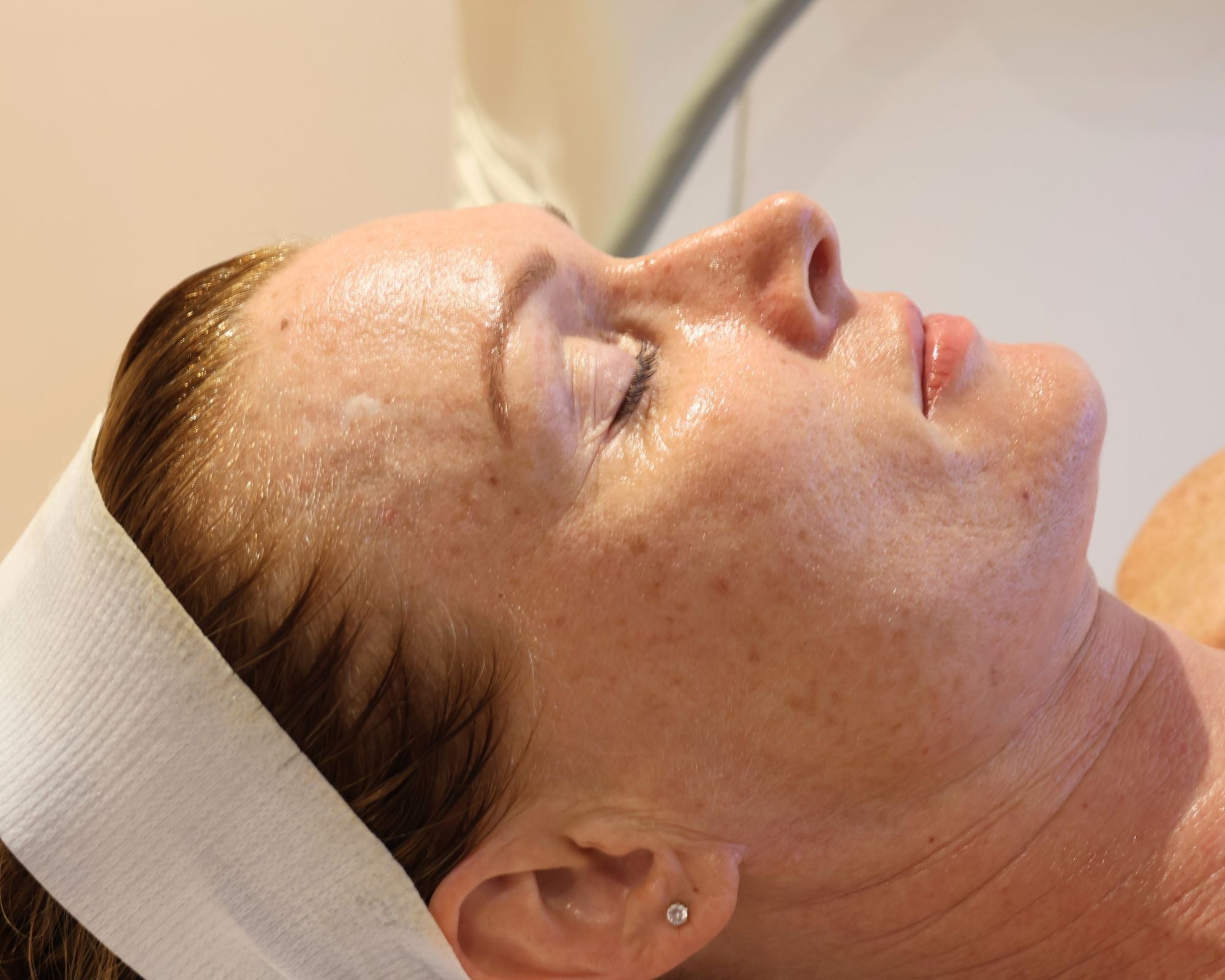 My Radiance Reset – Part Two