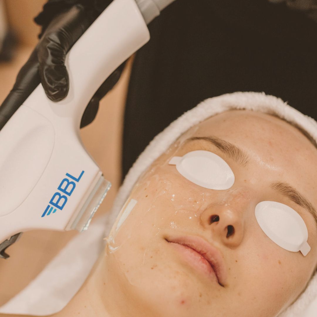 Clearer Skin Starts in Winter: Annette's Expert Guide to Treating Pigmentation